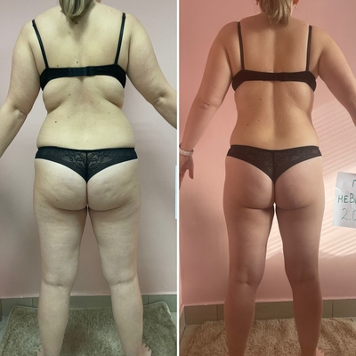 Love Body (Лав Боди), студия коррекции фигуры