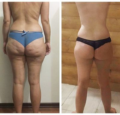 Будьте прекрасны! Идеальная фигура для Вас в салоне красоты со скидками до 57% «ELVIRA_BEAUTY_LOUNGE»!