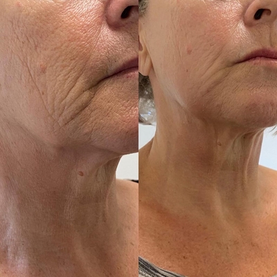 Здоровье и красота для Вашей кожи от клиники Дома Красоты со скидкой до 60% Здоровье и красота для Вашей кожи от клиники Дома Красоты со скидкой до 60%