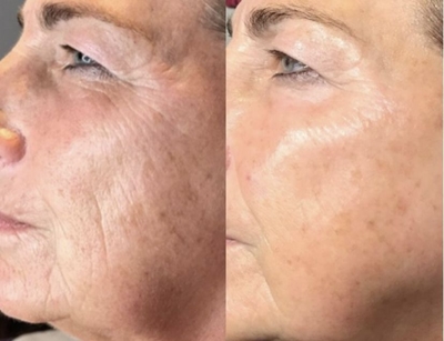 Здоровье и красота для Вашей кожи от клиники Дома Красоты со скидкой до 60% Здоровье и красота для Вашей кожи от клиники Дома Красоты со скидкой до 60%