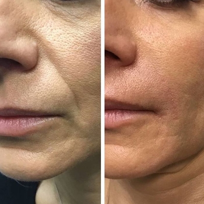 Здоровье и красота для Вашей кожи от клиники Дома Красоты со скидкой до 60% Здоровье и красота для Вашей кожи от клиники Дома Красоты со скидкой до 60%