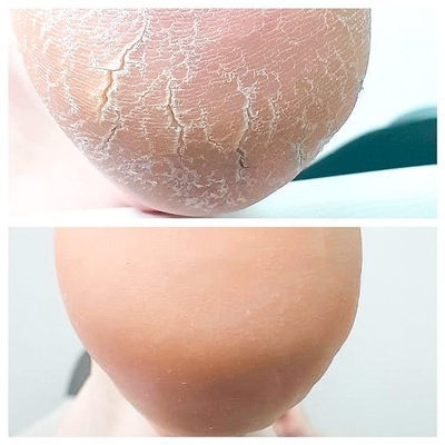 Услуги Центра Подологии и Ортопедии «TotalPodiatry» со скидкой до 50%!