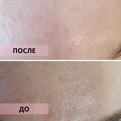 Услуги эстетической косметологии со скидкой до 55% от «NPraim»!