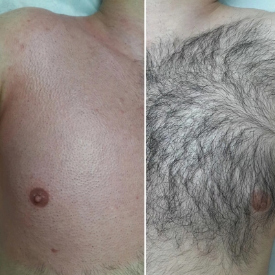 Студия депиляции и архитектуры бровей «BRENDA» со скидкой до 67%