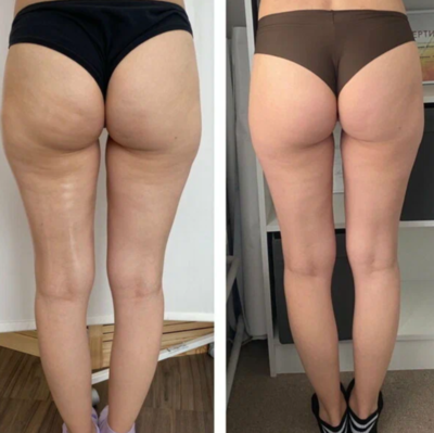  Ё-body (Ё-боди), студия Натальи Плетневой (коррекция лица и тела)