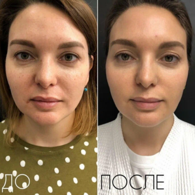 Ё-body (Ё-боди), студия Натальи Плетневой (коррекция лица и тела)