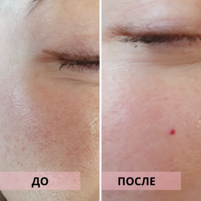 Услуги эстетической косметологии со скидкой до 55% от «NPraim»!