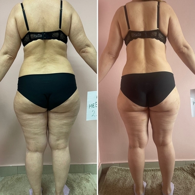 Love Body (Лав Боди), студия коррекции фигуры