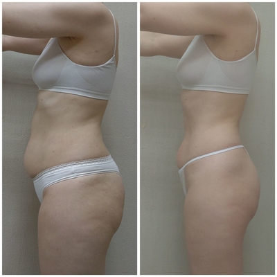 Body Dream (Боди дрим)