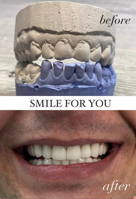 Улыбайтесь чаще! Стоматология «SMILE FOR YOU» дарит скидку до 40%
