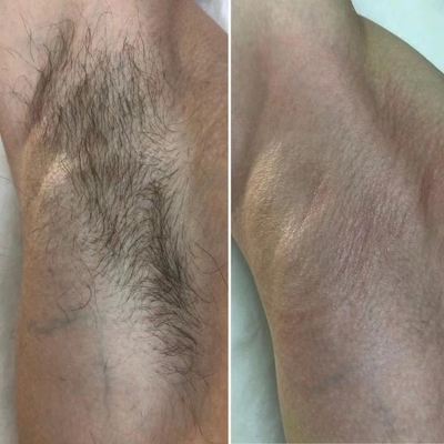 Студия депиляции и архитектуры бровей «BRENDA» со скидкой до 67%