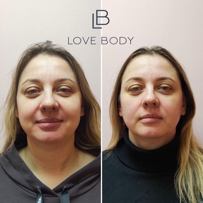 Love Body (Лав Боди), студия коррекции фигуры