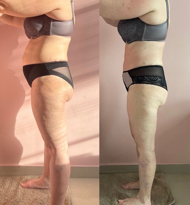 Love Body (Лав Боди), студия коррекции фигуры