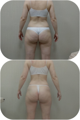 Body Dream (Боди дрим)