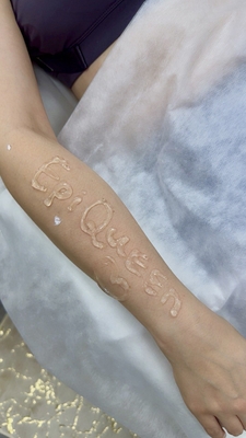 Лазерная эпиляция - гладкость, достойная королевы в студии эстетики тела «EPI QUEEN» со скидкой до 72% 