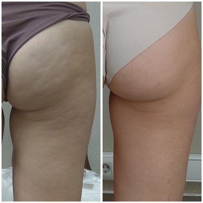 Body Dream (Боди дрим)