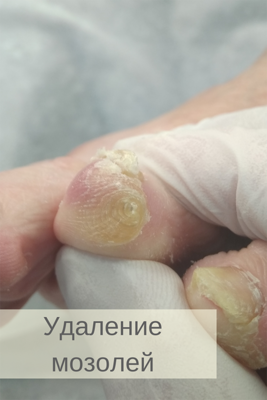 Услуги Центра Подологии и Ортопедии «TotalPodiatry» со скидкой до 50%!