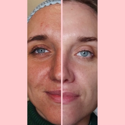 Услуги эстетической косметологии со скидкой до 55% от «NPraim»!