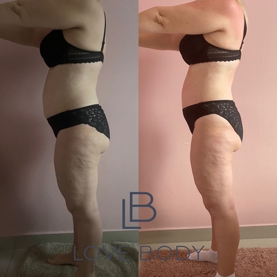 Love Body (Лав Боди), студия коррекции фигуры