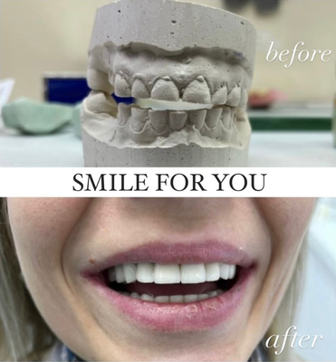 Улыбайтесь чаще! Стоматология «SMILE FOR YOU» дарит скидку до 40%