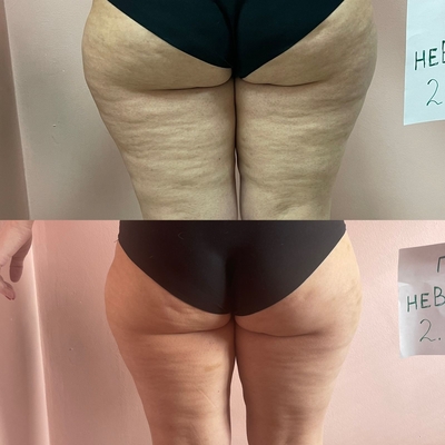 Love Body (Лав Боди), студия коррекции фигуры