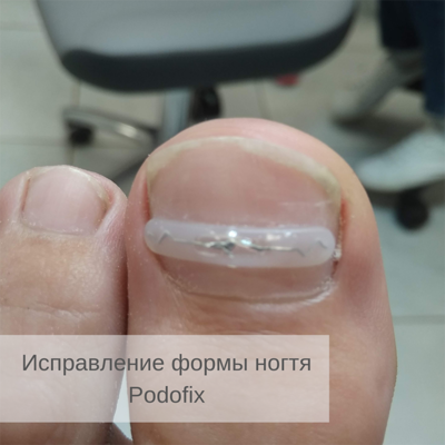 Услуги Центра Подологии и Ортопедии «TotalPodiatry» со скидкой до 50%!