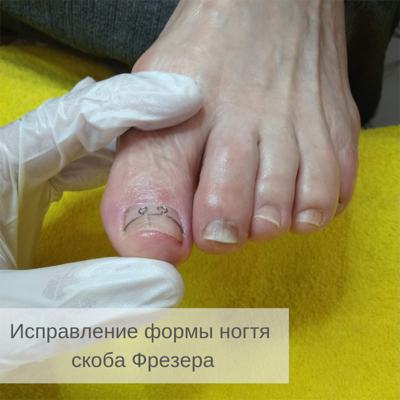 Услуги Центра Подологии и Ортопедии «TotalPodiatry» со скидкой до 50%!