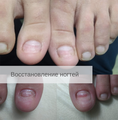 Услуги Центра Подологии и Ортопедии «TotalPodiatry» со скидкой до 50%!