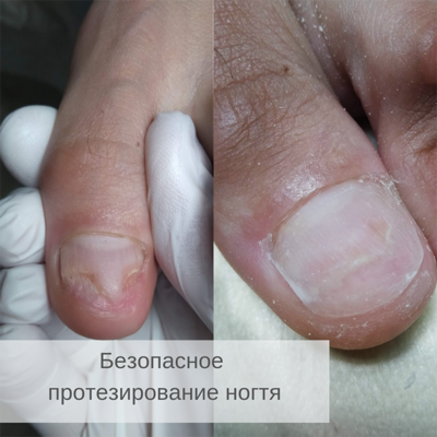 Услуги Центра Подологии и Ортопедии «TotalPodiatry» со скидкой до 50%!