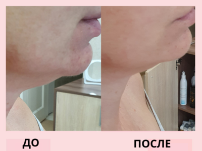 Услуги эстетической косметологии со скидкой до 55% от «NPraim»!