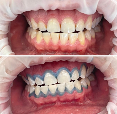 Улыбайтесь чаще! Стоматология «SMILE FOR YOU» дарит скидку до 50% Улыбайтесь чаще! Стоматология «SMILE FOR YOU» дарит скидку до 50%