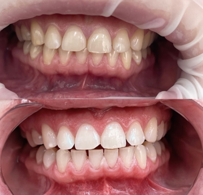 Улыбайтесь чаще! Стоматология «SMILE FOR YOU» дарит скидку до 60% Улыбайтесь чаще! Стоматология «SMILE FOR YOU» дарит скидку до 60%