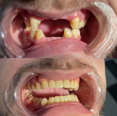 Улыбайтесь чаще! Стоматология «SMILE FOR YOU» дарит скидку до 60% Улыбайтесь чаще! Стоматология «SMILE FOR YOU» дарит скидку до 60%