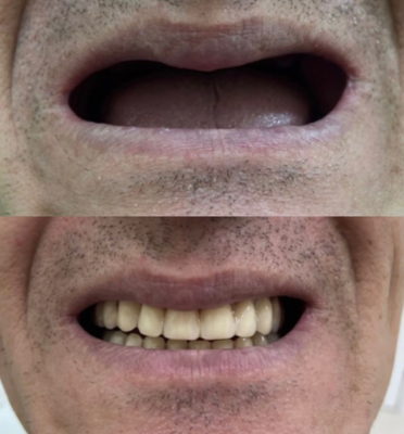 Улыбайтесь чаще! Стоматология «SMILE FOR YOU» дарит скидку до 50% Улыбайтесь чаще! Стоматология «SMILE FOR YOU» дарит скидку до 50%