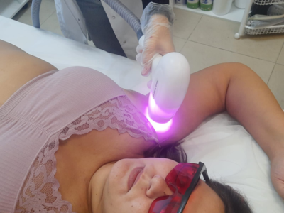 Лазерная эпиляция со скидкой до 50% в салоне «Женское счастье»!