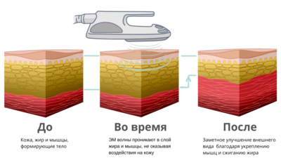 Фигура вызывающая восторг! RSL-скульптурирование и многое другое со скидкой до 61% в «Клинике Красоты»! Фигура вызывающая восторг! RSL-скульптурирование и многое другое со скидкой до 61% в «Клинике Красоты»!