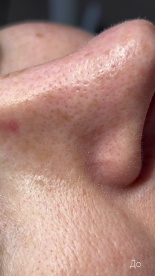 Косметологические услуги в студии «FaceLab Space» со скидкой до 55%! Косметологические услуги в студии «FaceLab Space» со скидкой до 55%!