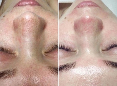 Скидка до 56% на косметологические услуги в студии «Тонус»!