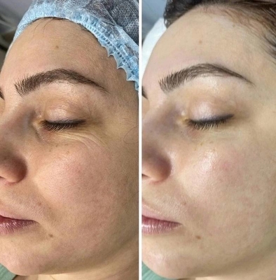 Скидка до 56% на косметологические услуги в студии «Тонус»!