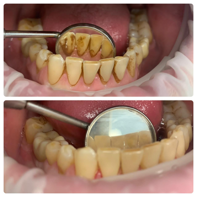 Улыбайтесь чаще! Стоматология «SMILE FOR YOU» дарит скидку до 50% Улыбайтесь чаще! Стоматология «SMILE FOR YOU» дарит скидку до 50%