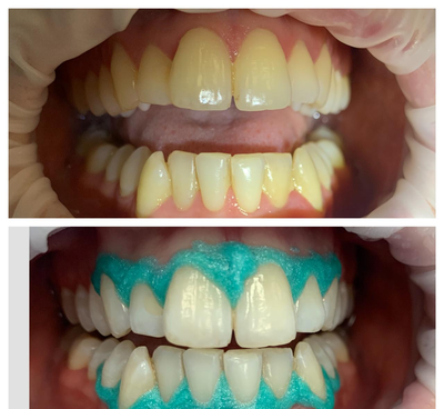 Улыбайтесь чаще! Стоматология «SMILE FOR YOU» дарит скидку до 50% Улыбайтесь чаще! Стоматология «SMILE FOR YOU» дарит скидку до 50%