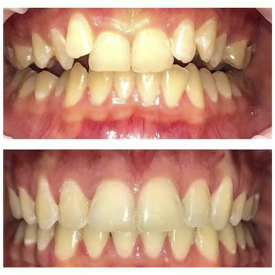 Стоматологическая клиника «Маг-Дент-Наири» дарит скидку до 71%!