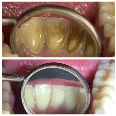 Стоматологическая клиника «Маг-Дент-Наири» дарит скидку до 71%! Стоматологическая клиника «Маг-Дент-Наири» дарит скидку до 71%!