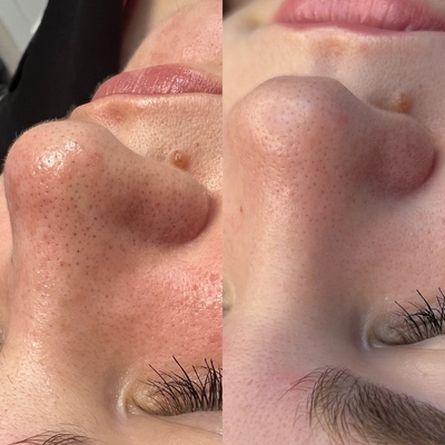 Косметологические услуги в салоне красоты «Pion» со скидкой!