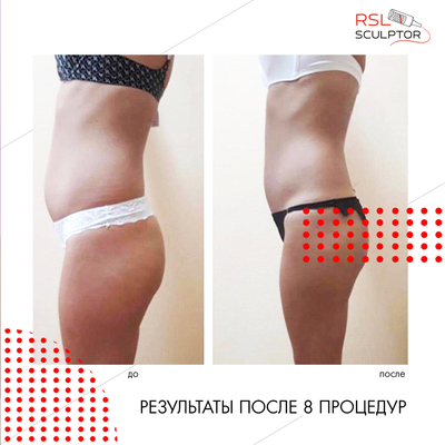 Фигура вызывающая восторг! RSL-скульптурирование и многое другое со скидкой до 61% в «Клинике Красоты»! Фигура вызывающая восторг! RSL-скульптурирование и многое другое со скидкой до 61% в «Клинике Красоты»!