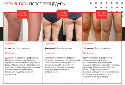 Фигура вызывающая восторг! RSL-скульптурирование и многое другое со скидкой до 61% в «Клинике Красоты»! Фигура вызывающая восторг! RSL-скульптурирование и многое другое со скидкой до 61% в «Клинике Красоты»!