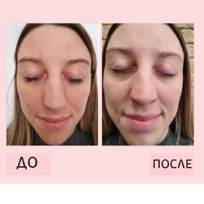 Услуги эстетической косметологии со скидкой до 55% от «NPraim»!