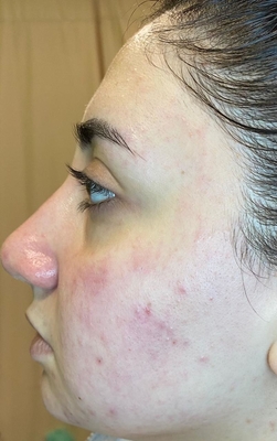 Процедуры по косметологии в студии красоты «Luciana Bravo» со скидкой до 44%