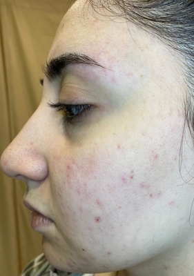 Процедуры по косметологии в студии красоты «Luciana Bravo» со скидкой до 44%