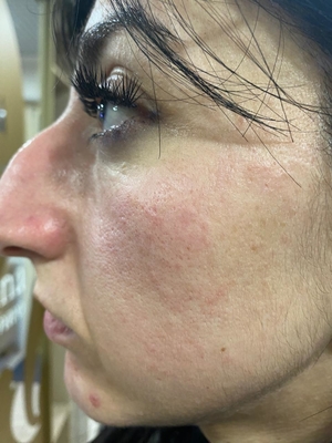 Процедуры по косметологии в студии красоты «Luciana Bravo» со скидкой до 44%